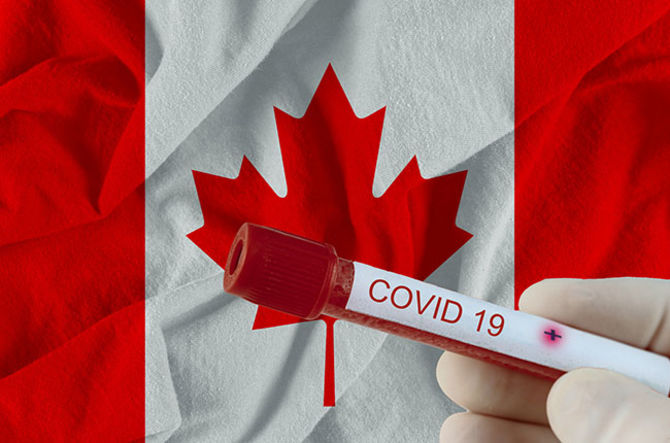 COVID-19 Coronavirus chinese infection of Canada with infection blood test in laboratory